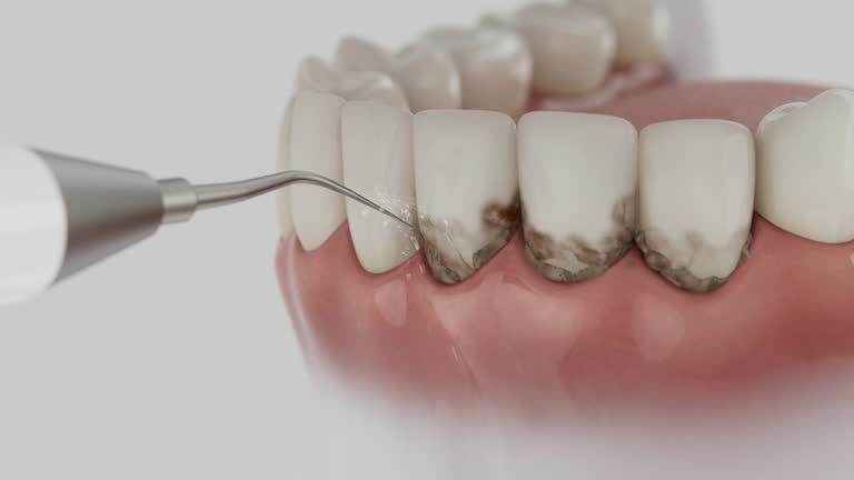 Trusted Root Canal Treatment service in Waxahachie, TX - Dentist Open Now